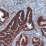 Immunohistoquímica i suport histològic